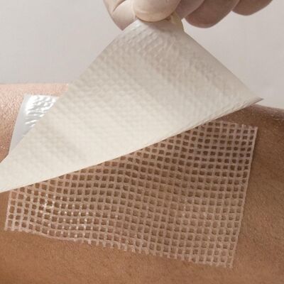 Применение повязки Парапран с хлоргексидином