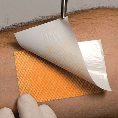 Повязка на рану Воскопран Левометил 5 х 7,5 см, мазевая, сетчатая на руке