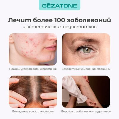 Дарсонваль Gezatone Biolift4 D309 (для чего подходит) Дарсонваль Gezatone Biolift4 D309 (для чего подходит)