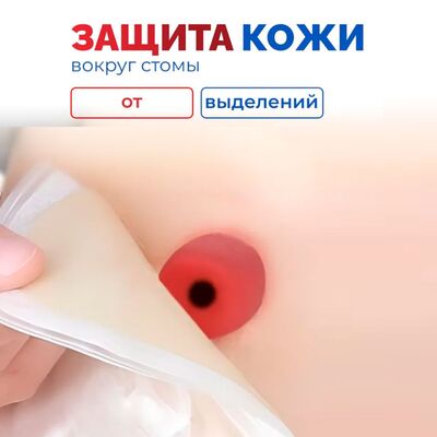 Защитная пленка для кожи вокруг стомы StomaHelp предотвращает травмы
